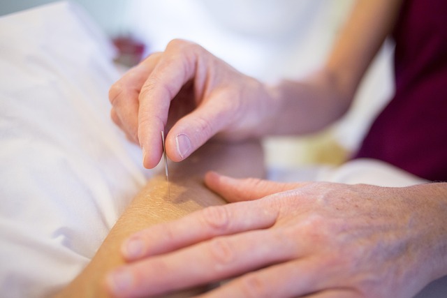 acupuncture, holistic healing, holistic, medicine, health, treatment, doctor, acupuncture, acupuncture, acupuncture, acupuncture, acupuncture